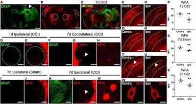 Changes in Brain Matrix Glycan Sulfation Associate With Reactive Gliosis and Motor Coordination in Mice With Head Trauma